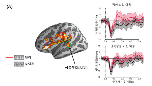 * 뇌자도(MEG, Magnetoencephalography): 腦磁圖. 신경 세포 간 전류 흐름으로 유도된 자기장을 측정하는 뇌기능영상법 (제공=부산대 주성준 교수 연구팀)